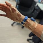 הקיבוע שיוצר במדפסת תלת מימד